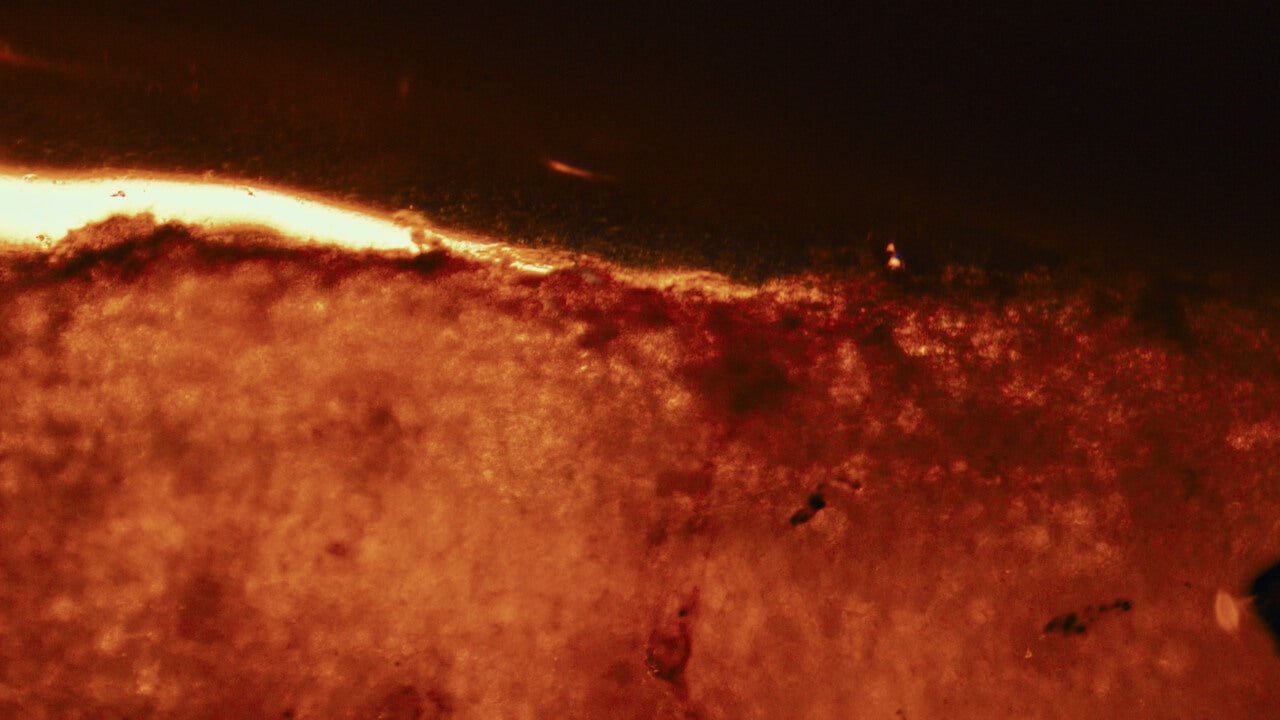 C-vitamin: från skörbjugg till cellskydd